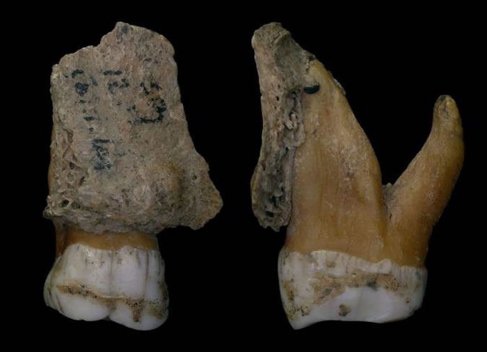 尼安德特人的牙齿特写，显示牙结石在牙釉质上形成一层外壳。 PHOTOGRAPH BY ROYAL BELGIAN INSTITUTE OF NATURE SCI