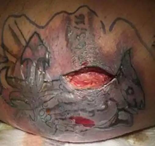 德州男子刚刺青就下水,感染海洋弧菌身亡(图/翻摄viralnova)