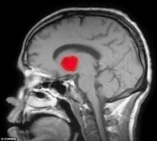 对于免疫系统健康的人来说，隐球菌通常是无害的。然而，对于那些免疫系统薄弱的人来说，如患有艾滋病或正在治疗癌症的人，一旦患上隐球菌脑膜炎，后果将是致命的。