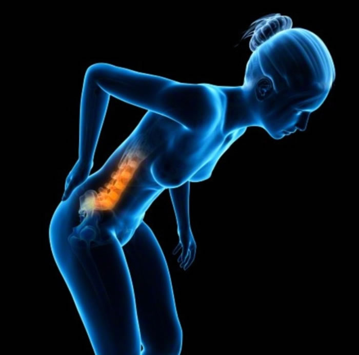 背痛困扰着不少成年女士