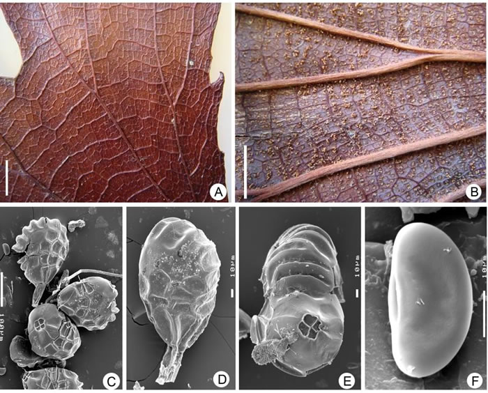 现生双扇蕨（Dipteris conjugata）的生殖叶片、孢子囊和孢子特征