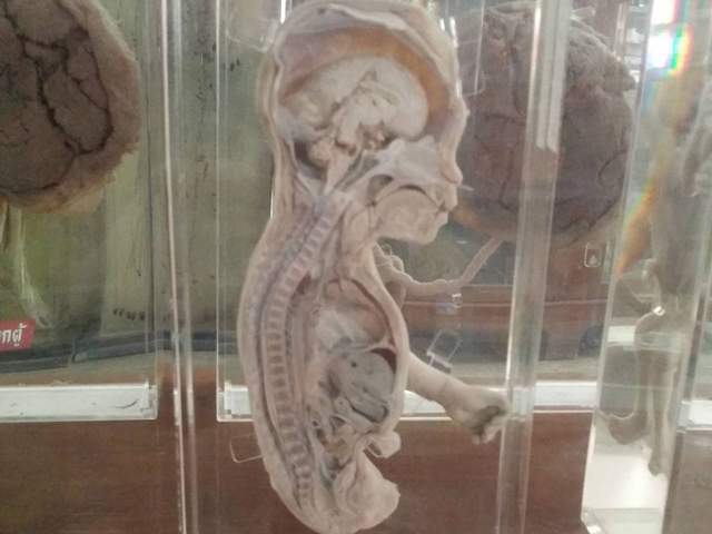 【阅览注意】泰国《死亡博物馆》沉睡着所有奇异的标本 - 图片7