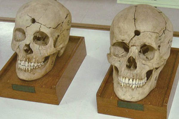 【阅览注意】泰国《死亡博物馆》沉睡着所有奇异的标本 - 图片1