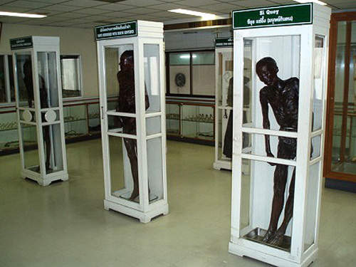 【阅览注意】泰国《死亡博物馆》沉睡着所有奇异的标本 - 图片9