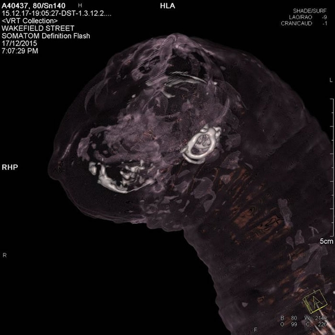 透过原子序成像所输出的南澳洲博物馆藏之猫木乃伊内部影像。 PHOTOGRAPH BY JAMES M. BEWES