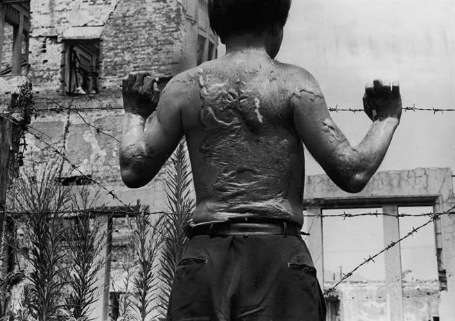 幸存的居民最后也都纷纷染上怪病。