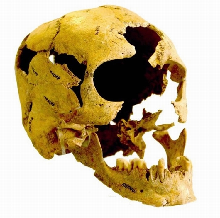 伊朗出土的10000年前新石器时代古人类头骨(photo/&copy;: Courtesy Fereidoun Biglari， National Museum