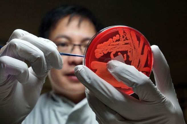 金黄色葡萄球菌是一种在环境中极之普遍存在的细菌，全世界人口有约三分之一的体内带有（verywell）