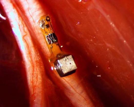 小鼠神经纤维上植入物的细节