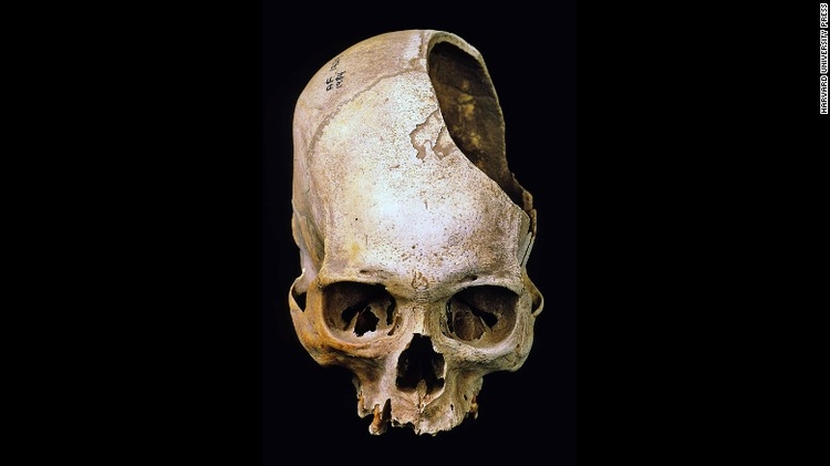 160720115357-06-holes-in-the-head-exlarge-169