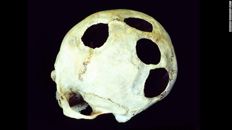 160720115401-09-holes-in-the-head-exlarge-169