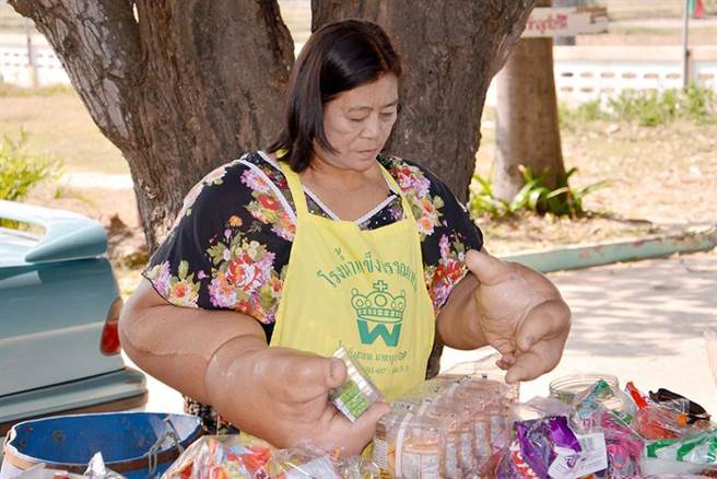 泰国59岁妇女沙马沙曼，一出生就罹患了罕见疾病。