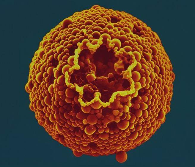 有壳变形虫是一类单细胞生物的混杂群体