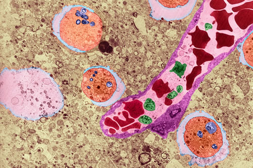 福氏纳格里阿米巴原虫小而阴险。 图片来源:伦敦卫生与热带医学学院