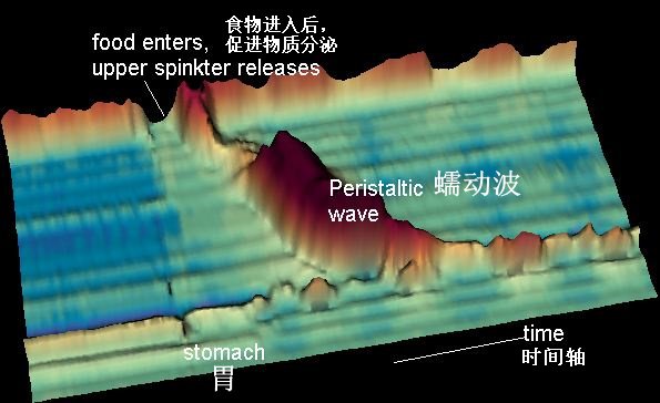 早晨喝完咖啡后为什么想拉屎？