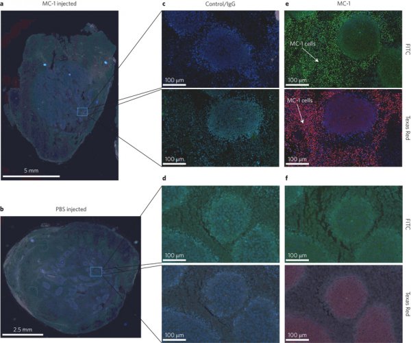 新思路：用细菌运送抗肿瘤药物