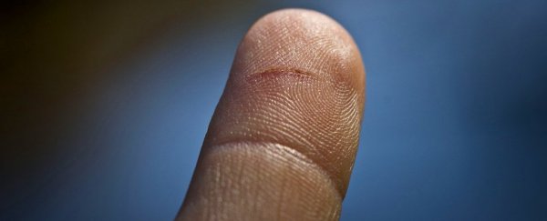 被纸割伤为何这么疼?