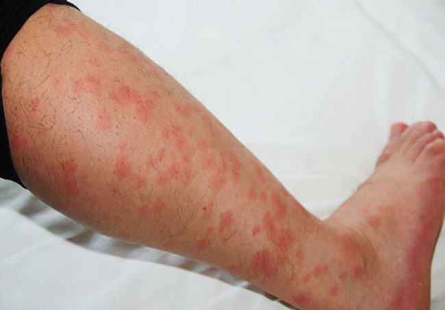 002tXfG8gy6Lp3ylJ8Sb2&690 002tXfG8gy6Lp3ylJ8Sb2&690