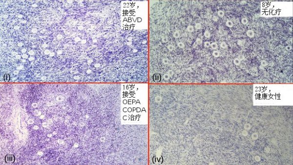 科学家首次发现女性卵巢能产生新卵子