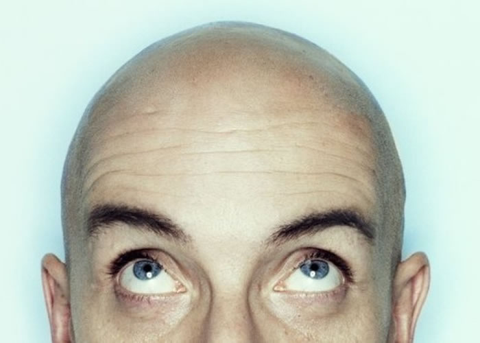 目前为止仍未有任何疗法可真正令头发重生。