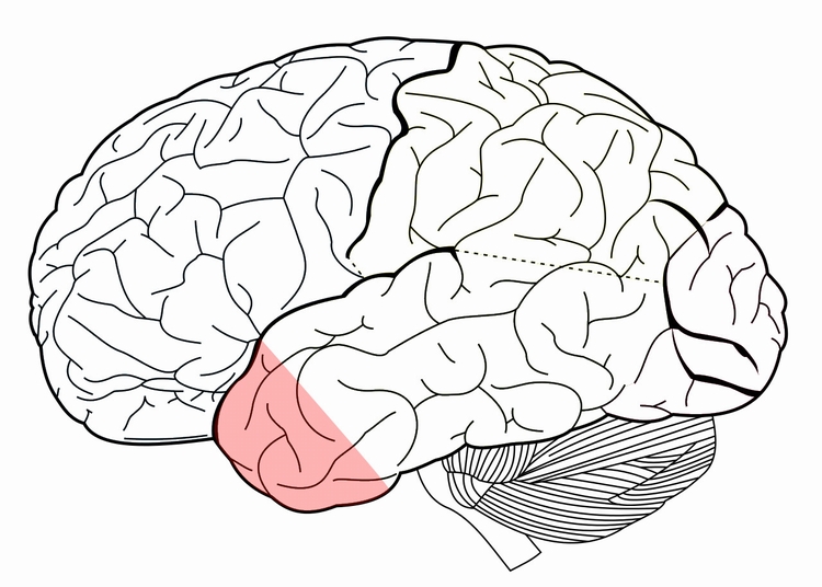 图中彩色部分即为颞极（temporal pole）。