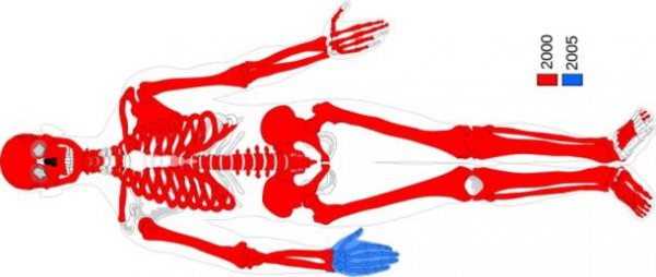 沼泽木乃伊:是失踪女孩还是古代女尸?