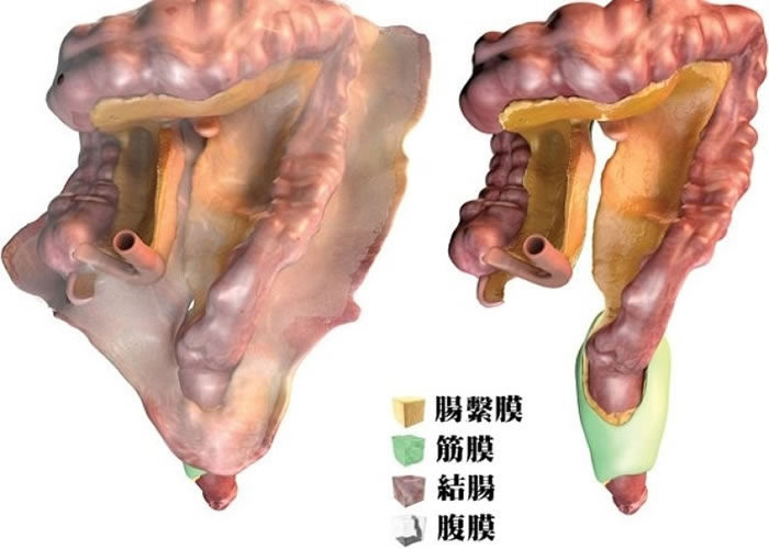 研究解构了肠系膜的结构。