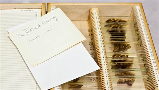 爱因斯坦的大脑切片。