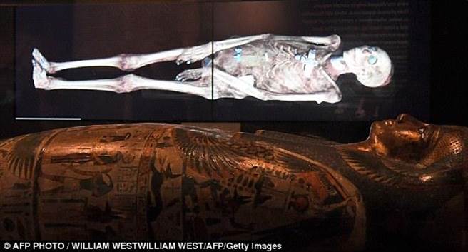 英国首次扫描埃及木乃伊 揭开3000年秘密