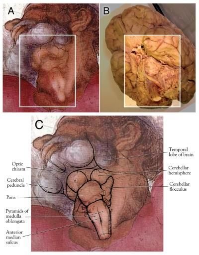 在米开朗基罗画作《创造亚当》里，到底是大脑还是子宫？