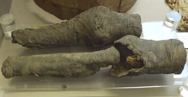 当年的盛世美颜,如今只剩一对膝盖