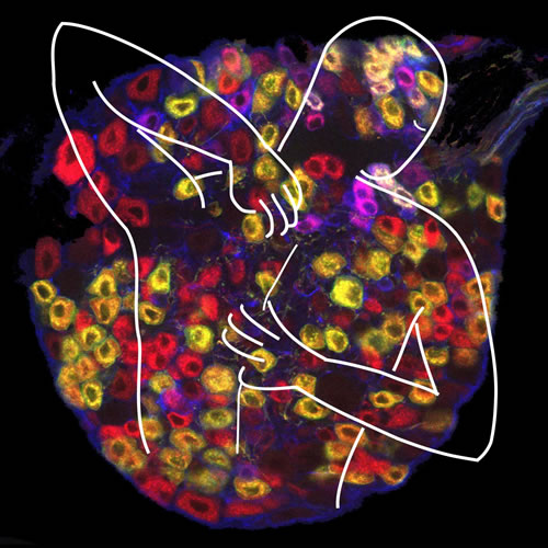 图片来源:董欣中等