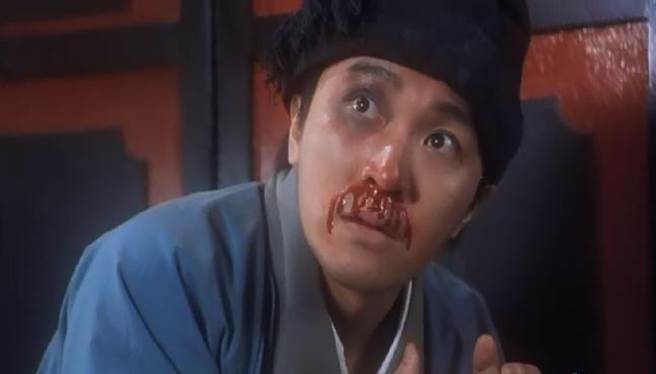 要是挖鼻子觉得鼻子越挖越大，还有时候挖到出血、有结痂物，那很可能就是因为鼻中隔偏曲惹的祸。