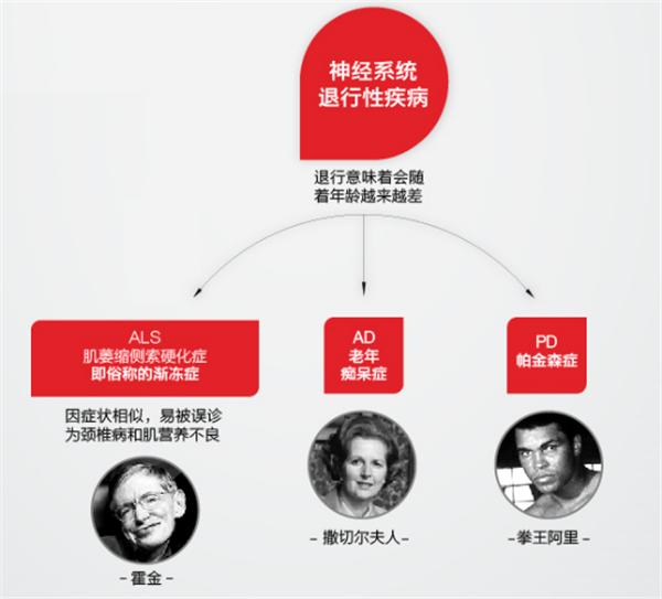 怎么区别帕金森病、老年痴呆和渐冻人症？